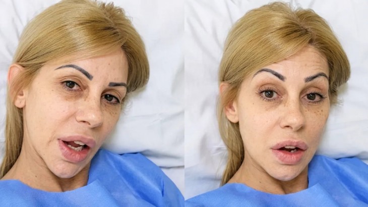 Mónica Farro fue operada tras una complicación con sus prótesis: "Me tuvieron que volver a abrir"