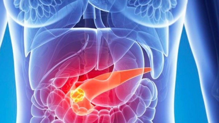 Científicos prueban un medicamento que podría frenar el cáncer de páncreas